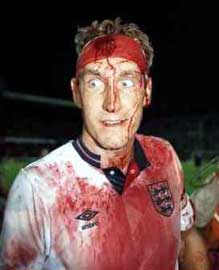 Terry Butcher  blood